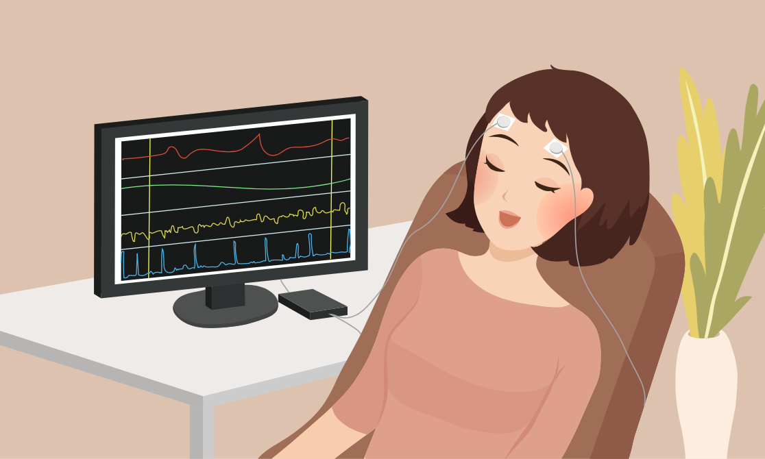 Neurofeedback Neurofeedback
